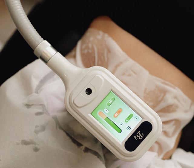 Cryolipolyse Sambreville