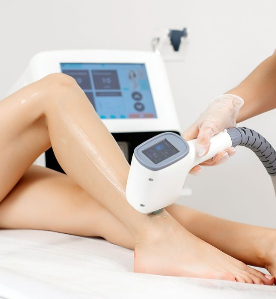 épilation au laser définitive